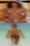 Nude sexy girls with diseases